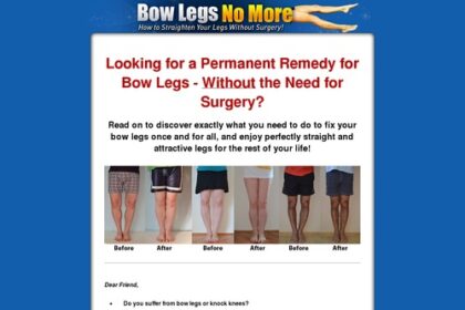 Bow Legs No Extra – Methods to Straighten Your Legs With out Surgical procedure!