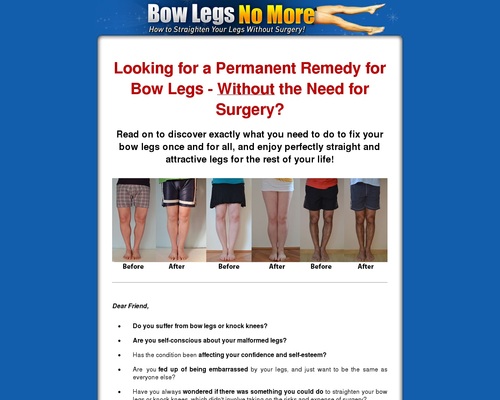 Bow Legs No Extra – Methods to Straighten Your Legs With out Surgical procedure!